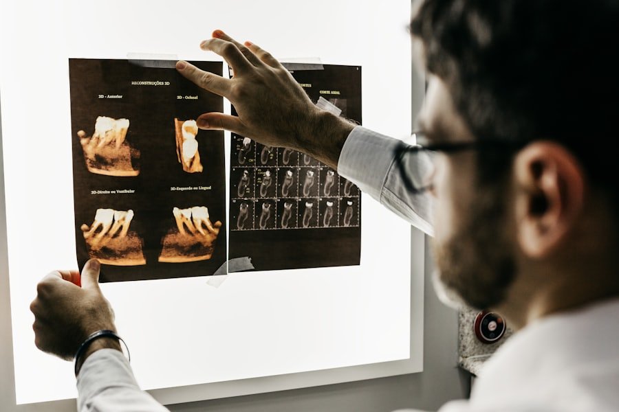 Dentista analisando reconstruções 3D para implante